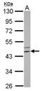 Ribosomal Protein S6 Kinase Related antibody, NBP2-14957, Novus Biologicals, Western Blot image 