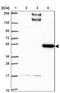 BEN Domain Containing 5 antibody, NBP2-31701, Novus Biologicals, Western Blot image 