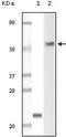 p56-LCK antibody, 32-186, ProSci, Western Blot image 