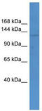 ATP Binding Cassette Subfamily C Member 12 antibody, TA331682, Origene, Western Blot image 