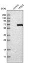 Vacuolar Protein Sorting 45 Homolog antibody, NBP1-81642, Novus Biologicals, Western Blot image 