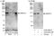 Ankyrin Repeat And Sterile Alpha Motif Domain Containing 1A antibody, A303-049A, Bethyl Labs, Western Blot image 