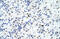 Forkhead Box P4 antibody, 29-132, ProSci, Enzyme Linked Immunosorbent Assay image 