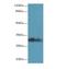 Ankyrin Repeat And SOCS Box Containing 8 antibody, LS-C379370, Lifespan Biosciences, Western Blot image 