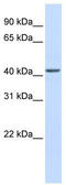 NIN1 (RPN12) Binding Protein 1 Homolog antibody, TA334494, Origene, Western Blot image 