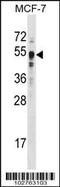 SET Domain Containing 7, Histone Lysine Methyltransferase antibody, 56-133, ProSci, Western Blot image 