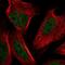 NSE4 Homolog A, SMC5-SMC6 Complex Component antibody, NBP2-55189, Novus Biologicals, Immunofluorescence image 