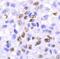 CREB Regulated Transcription Coactivator 3 antibody, A04568-2, Boster Biological Technology, Immunohistochemistry paraffin image 