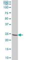 Crystallin Beta A2 antibody, H00001412-B02P, Novus Biologicals, Western Blot image 