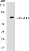 Lysophosphatidylcholine Acyltransferase 2 antibody, LS-C292157, Lifespan Biosciences, Western Blot image 