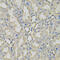Clathrin Heavy Chain antibody, 23-255, ProSci, Immunohistochemistry paraffin image 