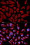 DNA Methyltransferase 3 Alpha antibody, 18-474, ProSci, Immunofluorescence image 