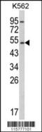 Cytochrome P450 Family 2 Subfamily E Member 1 antibody, 63-565, ProSci, Western Blot image 