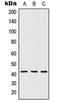 5-Hydroxytryptamine Receptor 1D antibody, LS-C352331, Lifespan Biosciences, Western Blot image 