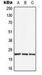 Apolipoprotein B MRNA Editing Enzyme Catalytic Subunit 3A antibody, orb215397, Biorbyt, Western Blot image 