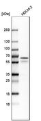 ETS Variant 6 antibody, NBP1-80695, Novus Biologicals, Western Blot image 