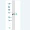 GLI Family Zinc Finger 1 antibody, H00002735-M02-100ug, Novus Biologicals, Western Blot image 