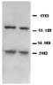 BCL2 Interacting Protein 3 antibody, PA1057, Boster Biological Technology, Western Blot image 