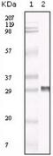 TIMP Metallopeptidase Inhibitor 3 antibody, LS-C172309, Lifespan Biosciences, Western Blot image 