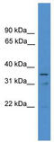 ETS Variant 2 antibody, TA329537, Origene, Western Blot image 