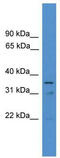 Er71 antibody, TA329537, Origene, Western Blot image 