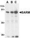 Sterile Alpha And TIR Motif Containing 1 antibody, PA1-30598, Invitrogen Antibodies, Western Blot image 
