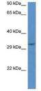 Jumonji Domain Containing 8 antibody, NBP1-79715, Novus Biologicals, Western Blot image 