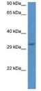 Jumonji Domain Containing 8 antibody, NBP1-79715, Novus Biologicals, Western Blot image 