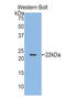 Semaphorin 3F antibody, LS-C296375, Lifespan Biosciences, Western Blot image 