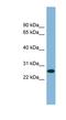 Serine And Arginine Rich Splicing Factor 12 antibody, NBP1-57405, Novus Biologicals, Western Blot image 