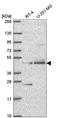 Ethanolamine-Phosphate Phospho-Lyase antibody, HPA072938, Atlas Antibodies, Western Blot image 