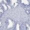 Hyaluronan And Proteoglycan Link Protein 1 antibody, HPA019482, Atlas Antibodies, Immunohistochemistry frozen image 