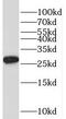 TPD52 Like 2 antibody, FNab08883, FineTest, Western Blot image 