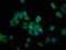 G Protein-Coupled Receptor Kinase 5 antibody, LS-C670188, Lifespan Biosciences, Immunofluorescence image 