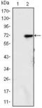 Lysine Demethylase 4A antibody, MA5-15678, Invitrogen Antibodies, Western Blot image 