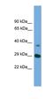 Autophagy Related 16 Like 1 antibody, orb331008, Biorbyt, Western Blot image 