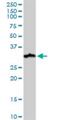 Nudix Hydrolase 21 antibody, H00011051-M01, Novus Biologicals, Western Blot image 