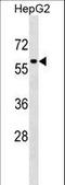 Transcription Factor EB antibody, LS-C157175, Lifespan Biosciences, Western Blot image 