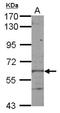 Kelch Like Family Member 28 antibody, NBP2-17083, Novus Biologicals, Western Blot image 