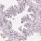 Tetratricopeptide Repeat Domain 23 Like antibody, NBP1-83559, Novus Biologicals, Immunohistochemistry paraffin image 