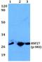 Heat Shock Protein Family B (Small) Member 1 antibody, A00676S82-1, Boster Biological Technology, Western Blot image 