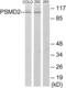 Proteasome 26S Subunit, Non-ATPase 2 antibody, LS-C119010, Lifespan Biosciences, Western Blot image 