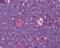 Adenosine Deaminase antibody, 49-654, ProSci, Immunohistochemistry paraffin image 