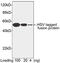 Herpes Simplex Virus tag antibody, LS-C51500, Lifespan Biosciences, Western Blot image 