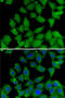 RB Binding Protein 7, Chromatin Remodeling Factor antibody, 14-998, ProSci, Immunofluorescence image 