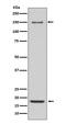 Integrin Subunit Alpha 5 antibody, M01911, Boster Biological Technology, Western Blot image 