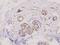 Mitogen-Activated Protein Kinase Kinase 1 antibody, A00292T292, Boster Biological Technology, Immunohistochemistry paraffin image 