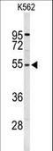 Ribosomal Protein S6 Kinase B2 antibody, LS-C162757, Lifespan Biosciences, Western Blot image 