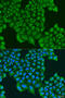 ATP Synthase Inhibitory Factor Subunit 1 antibody, 19-532, ProSci, Immunofluorescence image 