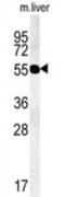 Transmembrane Protein 79 antibody, abx032469, Abbexa, Western Blot image 